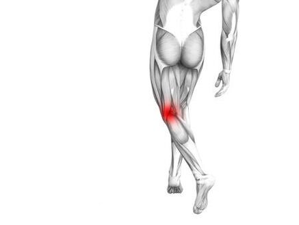Arthrose de l'articulation du genou