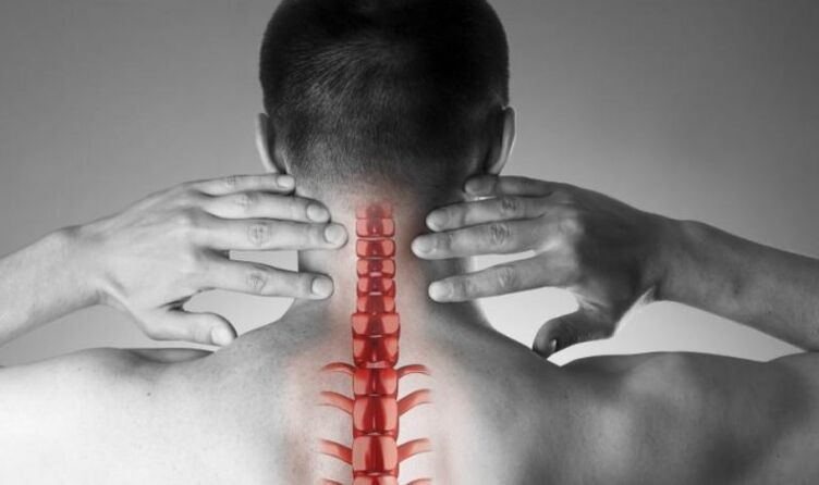 Douleur intense dans le syndrome neurologique